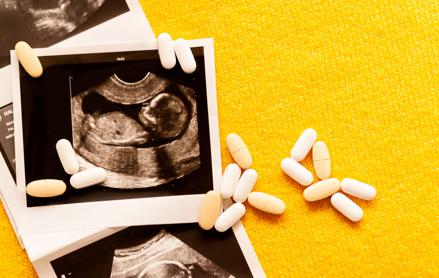 sonogram pills