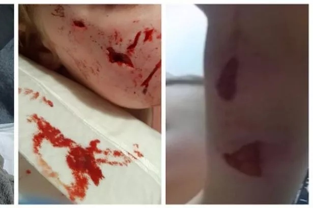 Flagler County Sheriff’s Office Incident Report #FC-2025-11489