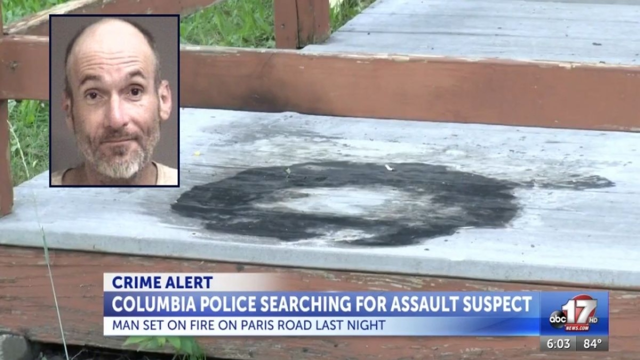 Horrific Arson: Man Severely Burned in Porch Attack, 80% Skin Damage — POLICE INVESTIGATE